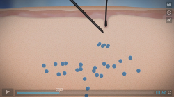 Informationsvideo der Deutschen Gesellschaft f�r Mesotherapie