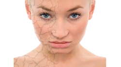 Brosch�re Mesotherapie